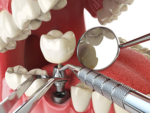 Best Emergency Denture Repair in Emerald Lake Hills, CA